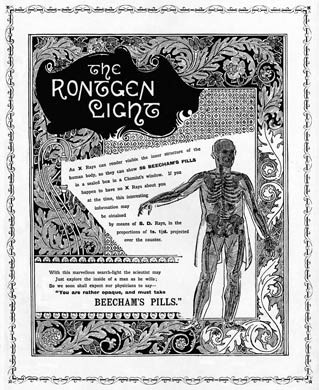 Beechams Pills, Rontgen Rays