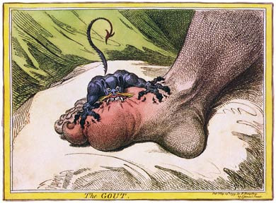 The Gout, James Gillray, 1799