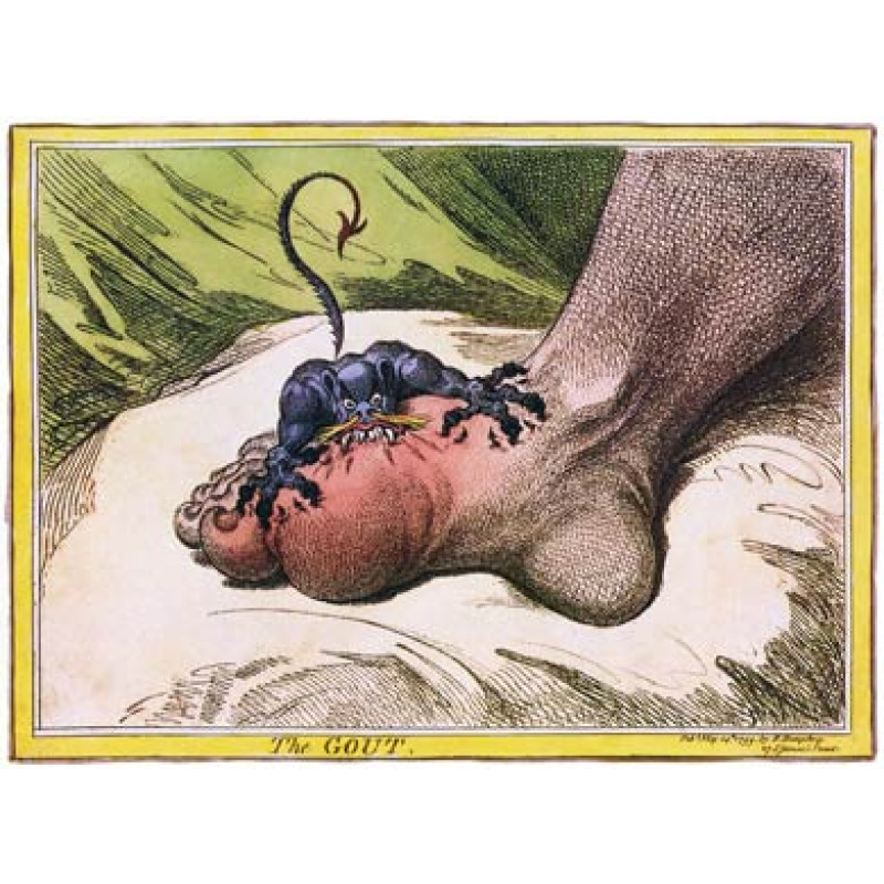 The Gout, James Gillray, 1799